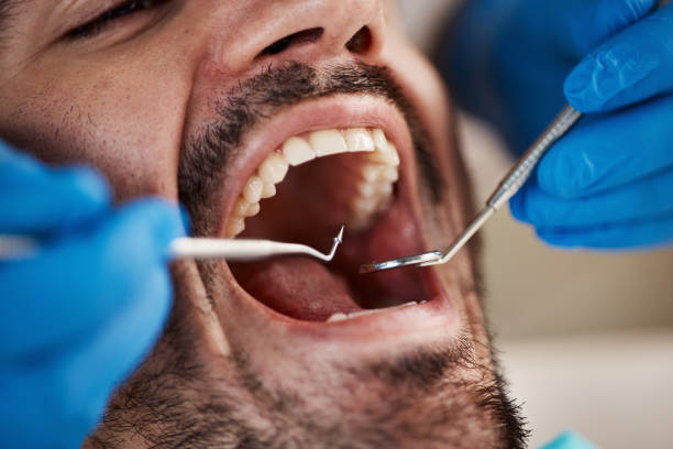 Best Emergency Root Canal Treatment in Eden, NC